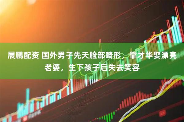 展鵬配资 国外男子先天脸部畸形，靠才华娶漂亮老婆，生下孩子后失去笑容